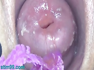 Japanese Endoscope Cam Inside Cervix And Pussy
